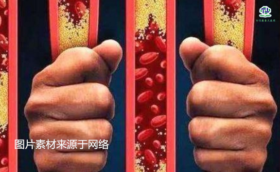 不想給血管“添堵”，盡量少吃以下這些東西，或許能讓腦梗離遠(yuǎn)些  